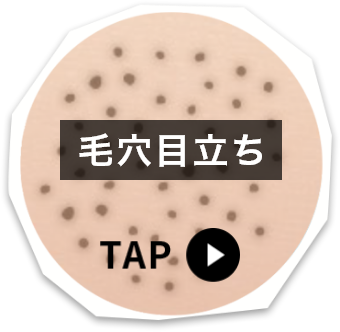 毛穴目立ち