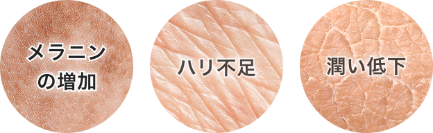 メラニンの増加 ハリ不足 潤い低下